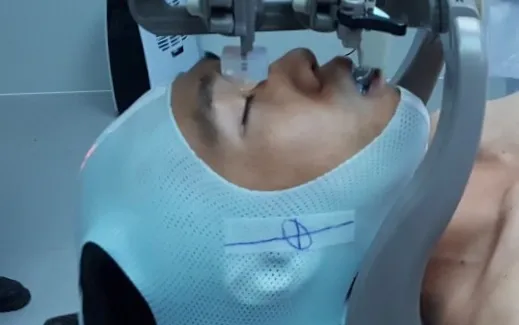 Xạ trị định vị thân cho bệnh nhân ung thư đầu cổ