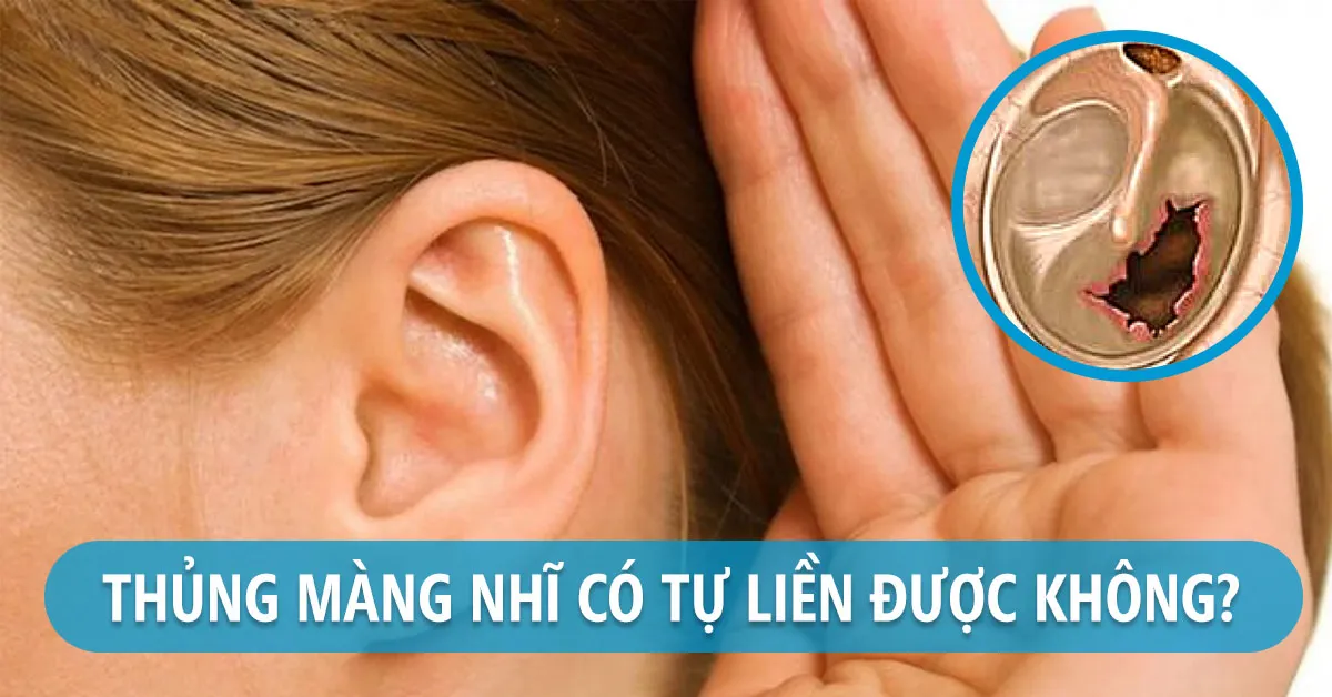 Thủng màng nhĩ có nghe được không?