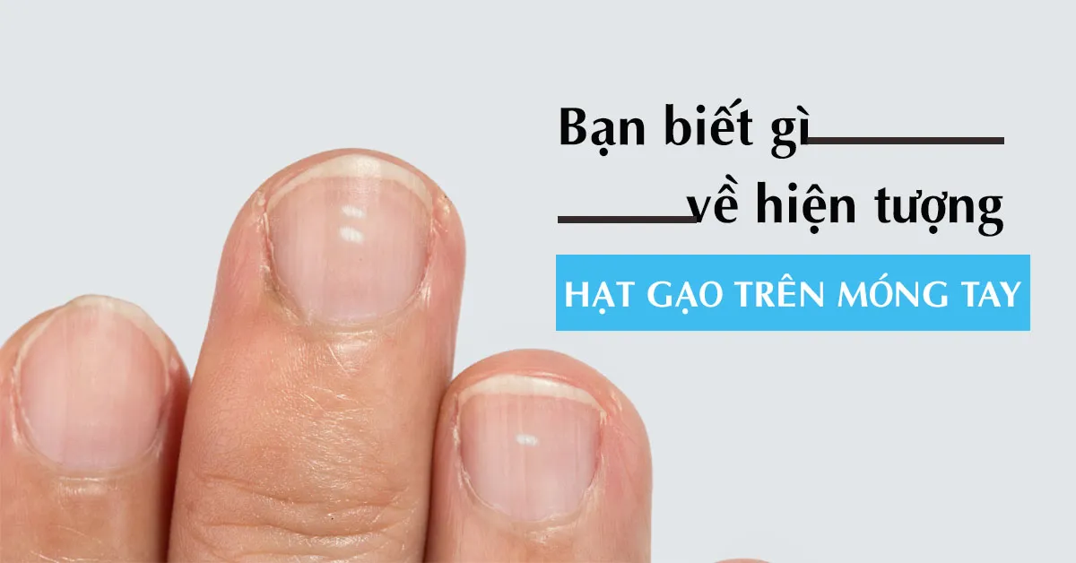 Móng tay có đốm trắng nói lên điều gì về sức khỏe?