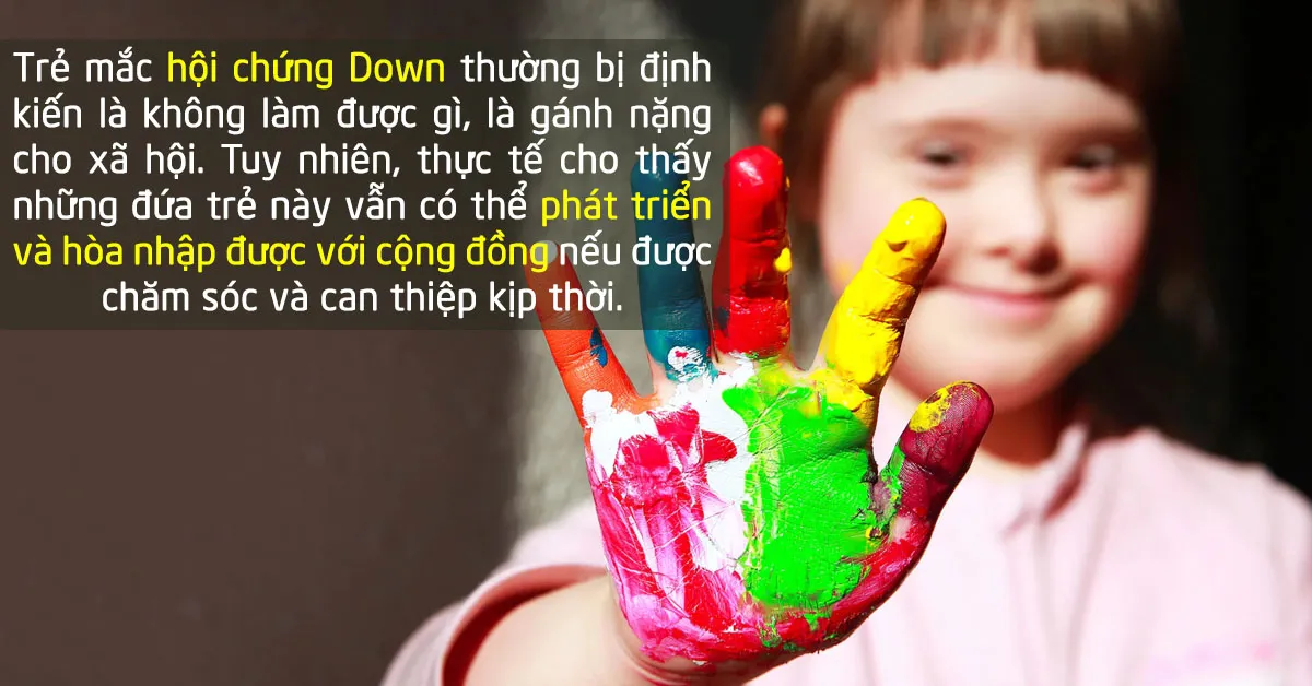 Hội chứng Down ở trẻ em và những điều cần biết