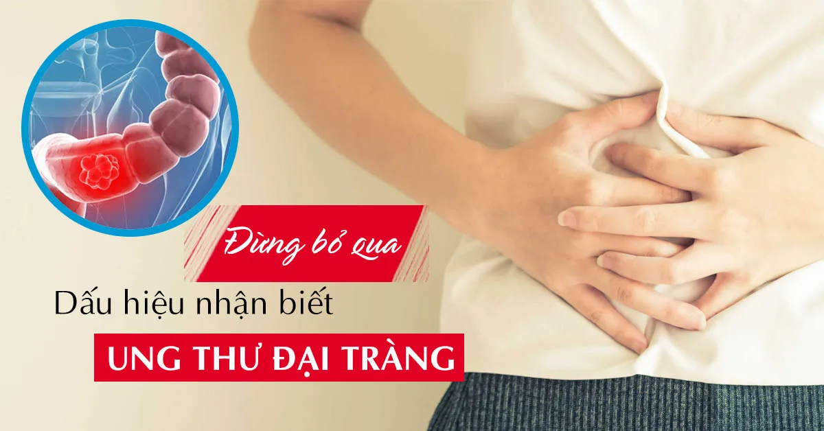 Ung thư đại tràng: Nguyên nhân, dấu hiệu nhận biết và cách điều trị