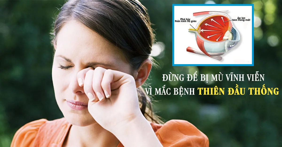 Bệnh thiên đầu thống nguy hiểm tới mức nào?