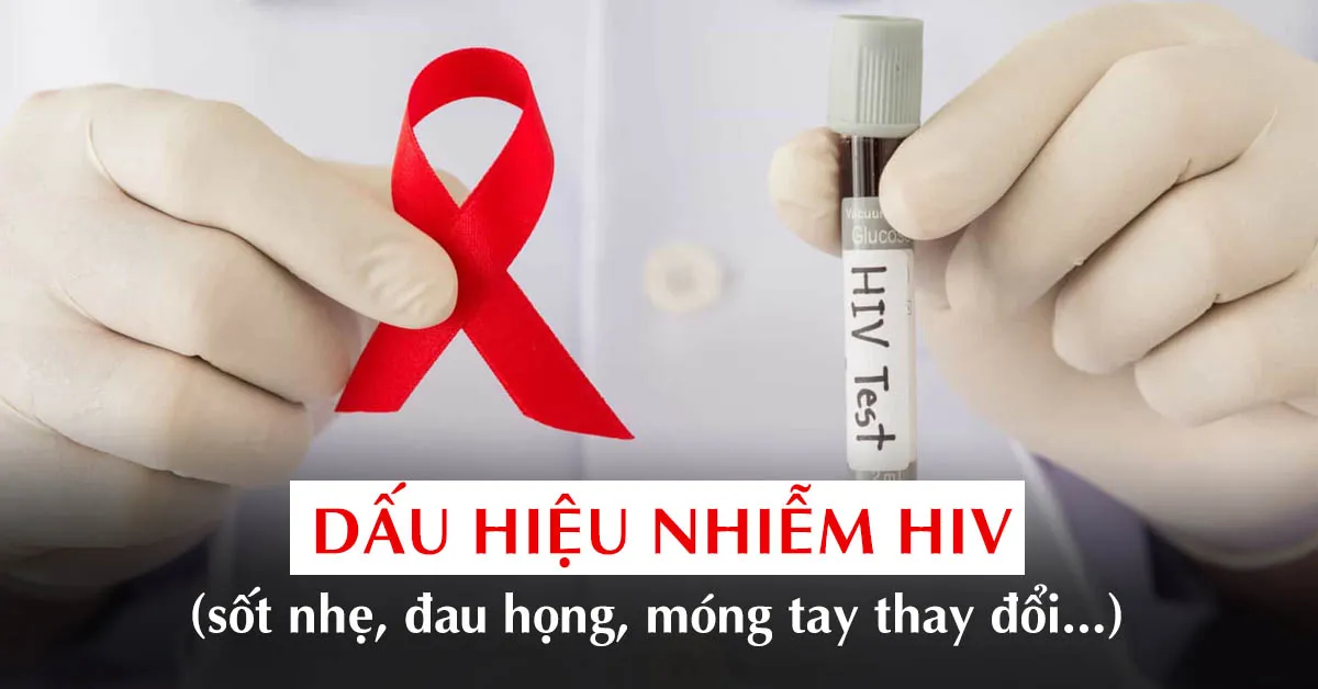 12 dấu hiệu nhiễm HIV không nên chủ quan bỏ qua