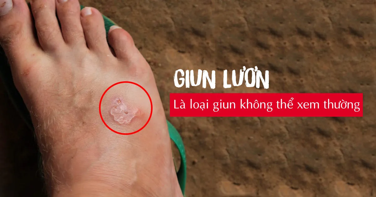 Giun lươn nguy hiểm như thế nào?