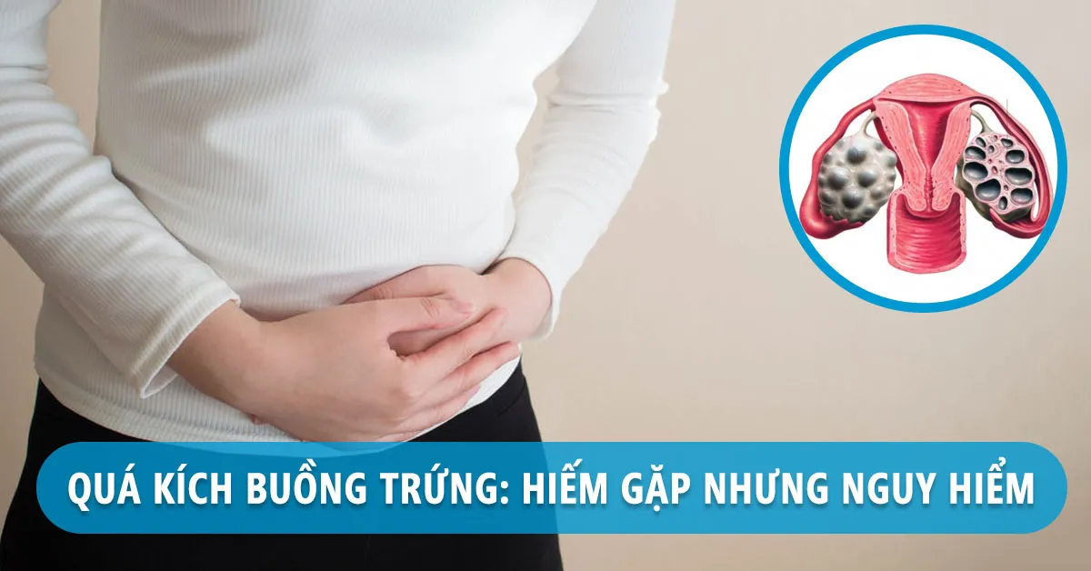 Hội chứng quá kích buồng trứng là gì? Có nguy hiểm không?