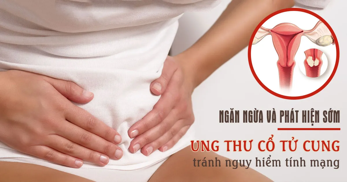 Những điều bạn cần biết về bệnh ung thư cổ tử cung