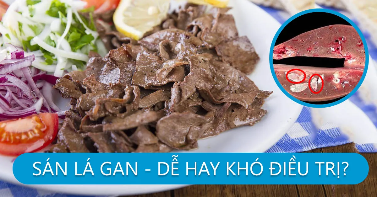 Sán lá gan có nguy hiểm không?