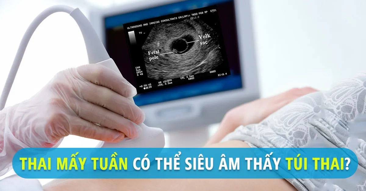 Túi thai là gì và mốc thời gian siêu âm có thể thấy túi thai?