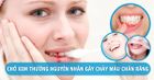 10 nguyên nhân gây chảy máu chân răng có thể bạn chưa biết