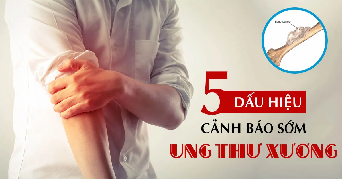 Ung thư xương và những dấu hiệu nhận biết, không thể bỏ qua