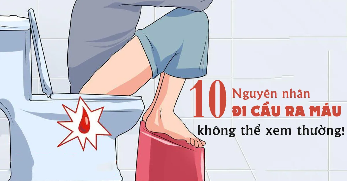 Đi cầu ra máu và những nguyên nhân không thể xem thường