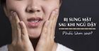 Những nguyên nhân gây sưng mặt, có thể bạn chưa biết