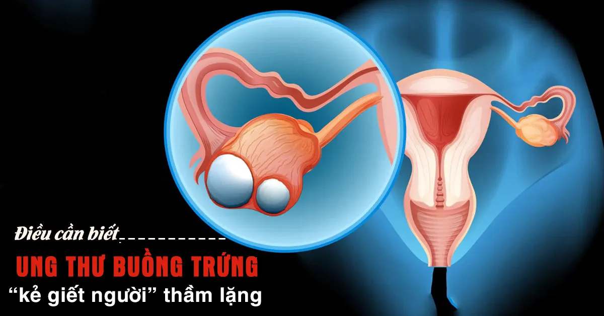 Ung thư buồng trứng nguy hiểm thế nào, có thể điều trị và phòng ngừa?