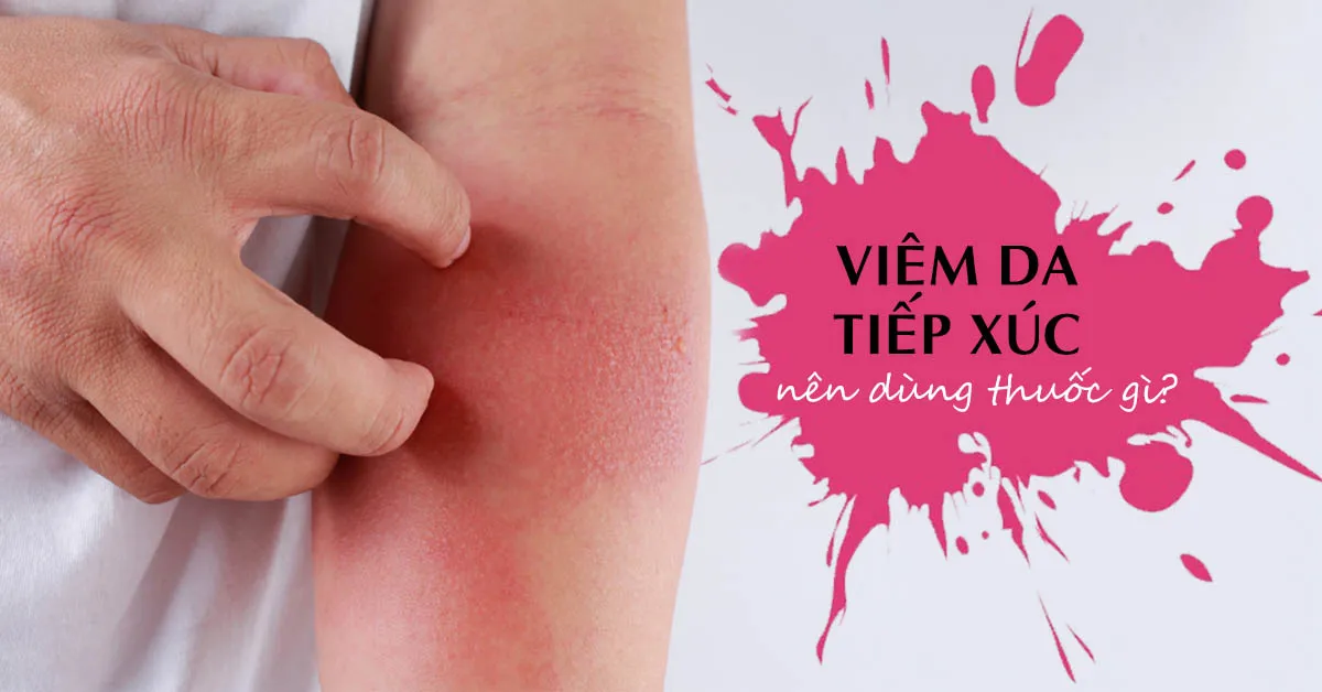 Viêm da tiếp xúc – dấu hiệu nhận biết sớm và cách điều trị nhanh nhất