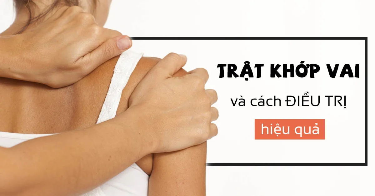 Trật khớp vai và cách điều trị hiệu quả, nhanh chóng hồi phục