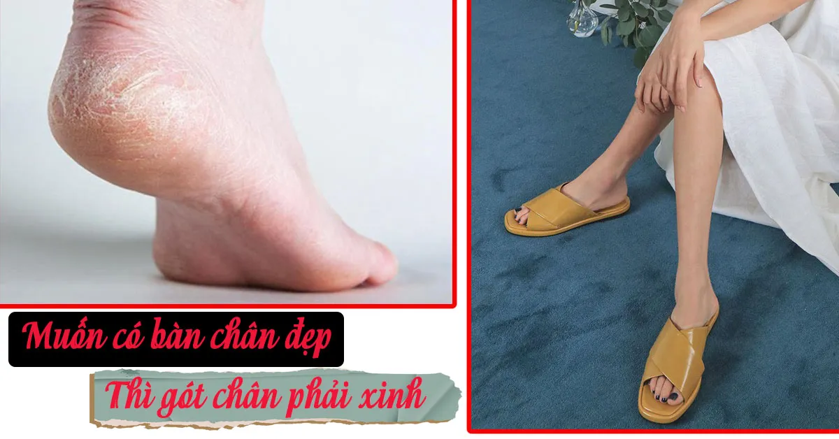 Cách làm mềm gót chân để nàng tự tin với mọi kiểu giày dép