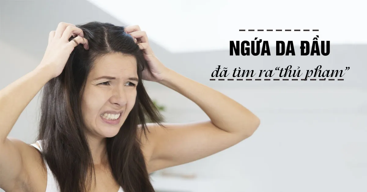 Ngứa da đầu - Nguyên nhân và cách khắc phục