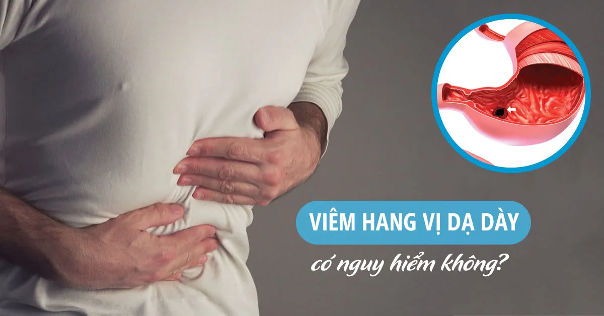 Viêm hang vị dạ dày có nguy hiểm không, chữa trị bằng cách nào?