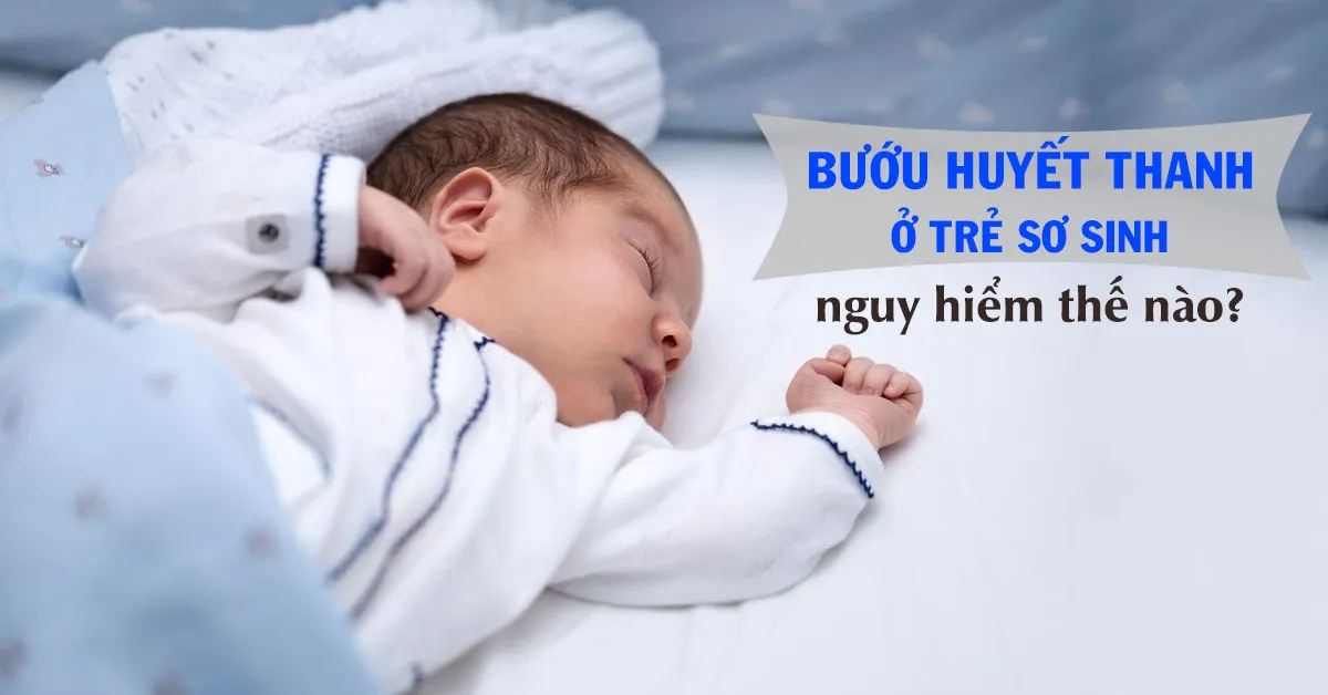 Bướu huyết thanh ở trẻ sơ sinh có nguy hiểm không?