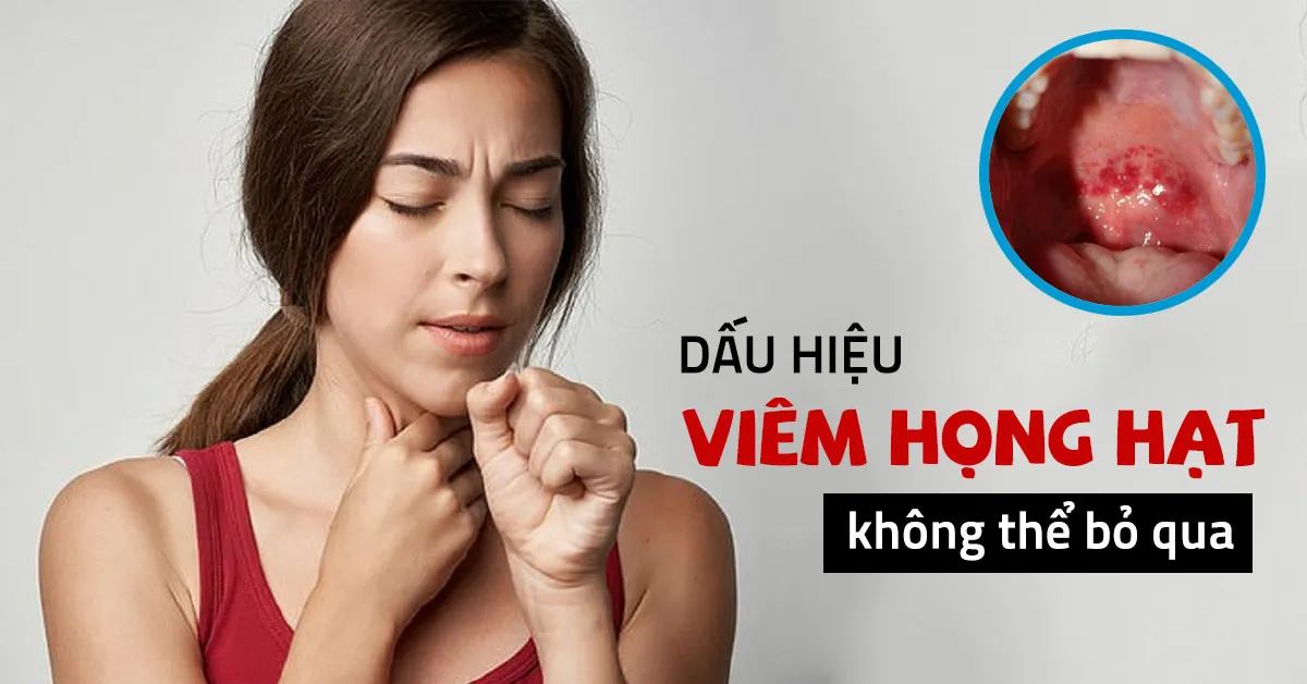 Viêm họng hạt - Dấu hiệu nhận biết cùng nhiều cách chữa hiệu quả