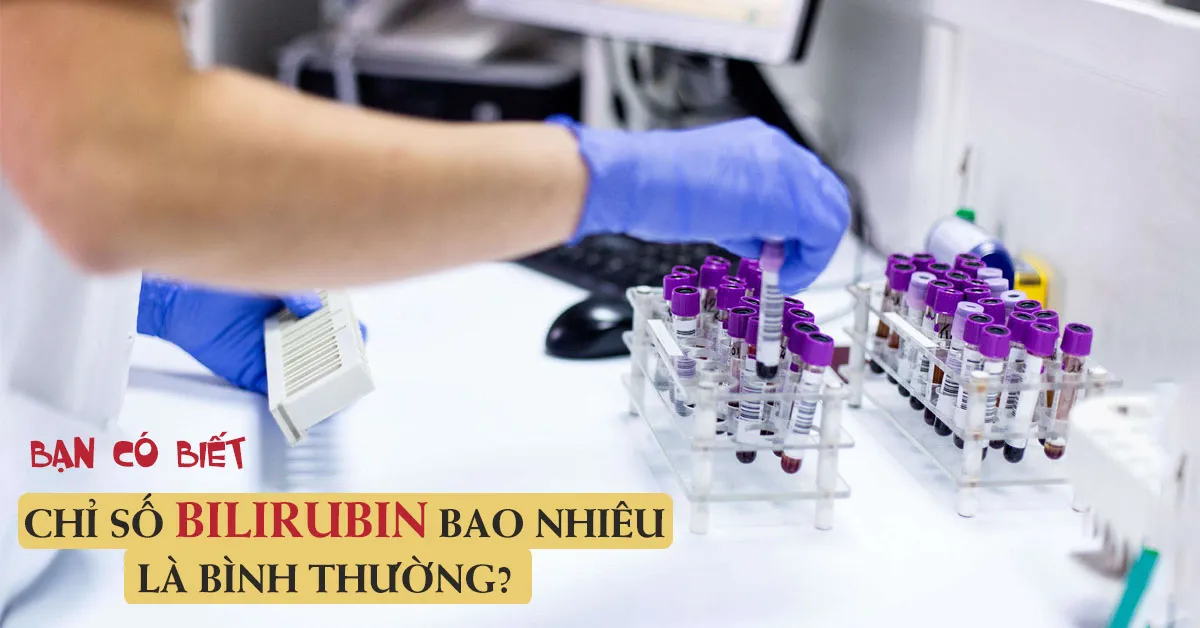 Tìm hiểu ý nghĩa các chỉ số của xét nghiệm bilirubin