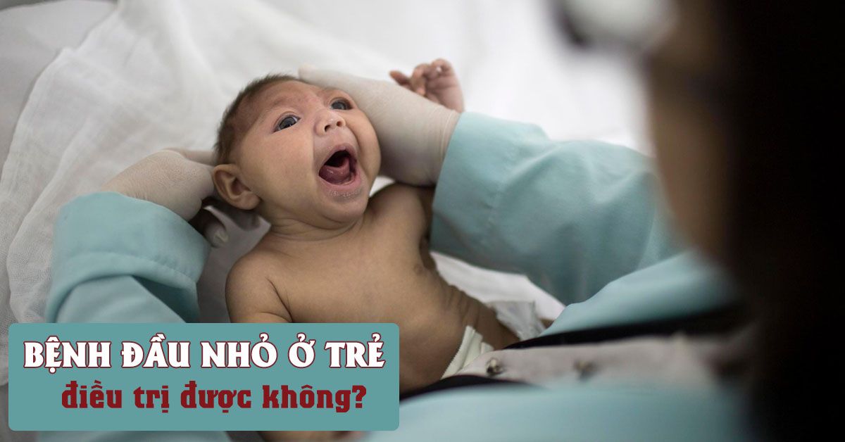 Bệnh đầu nhỏ - bệnh nguy hiểm về thần kinh ở trẻ