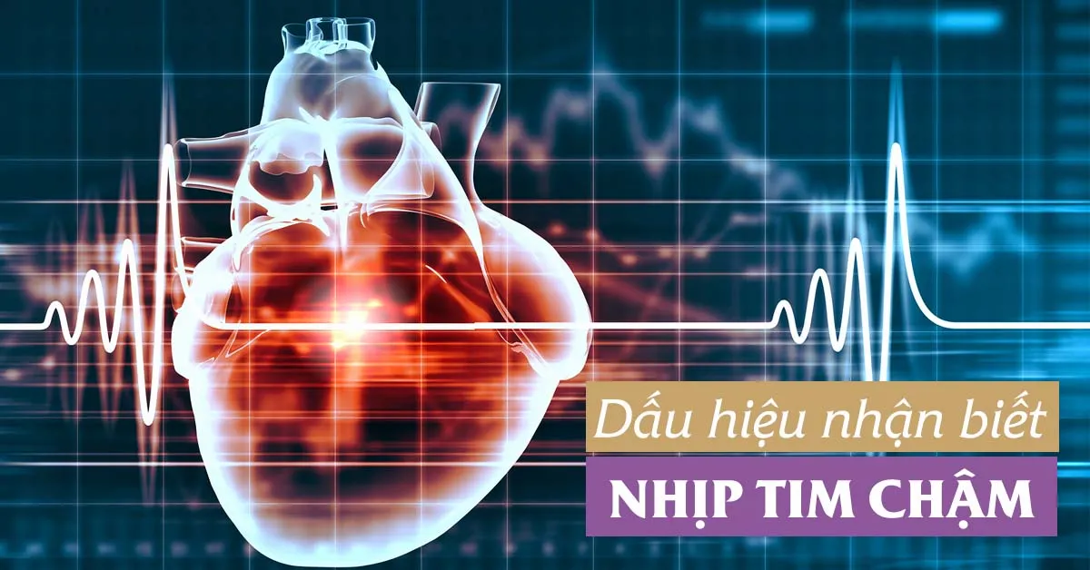 Nhịp tim chậm: Nguyên nhân và cách xử lý khi mắc bệnh