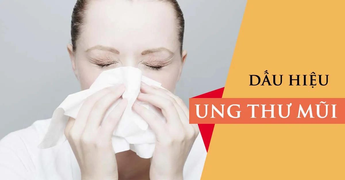 Ung thư mũi – nguyên nhân, dấu hiệu nhận biết và cách điều trị