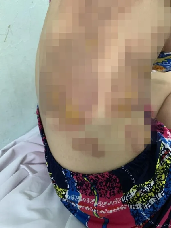 Tin pháp luật hôm nay 13/6/2019: Nhắc nhở đậu xe trước nhà, người phụ nữ bị tạt chảo dầu sôi