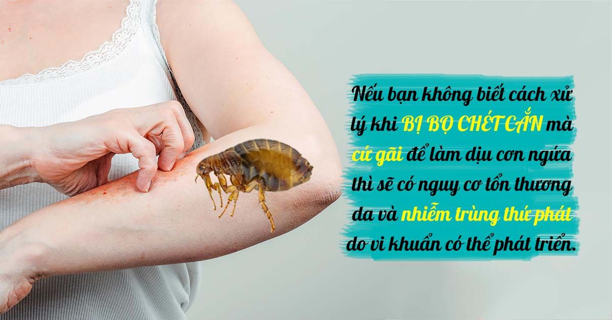 Bọ chét cắn nên làm gì?