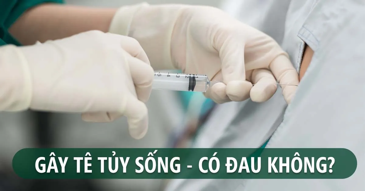 Gây tê tủy sống có đau không, tác dụng phụ là gì?