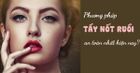 Tẩy nốt ruồi - những lưu ý bạn nhất định phải biết trước khi thực hiện