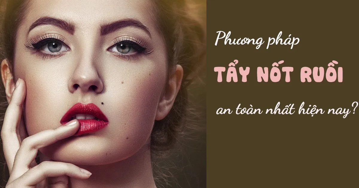 Tẩy nốt ruồi - những lưu ý bạn nhất định phải biết trước khi thực hiện