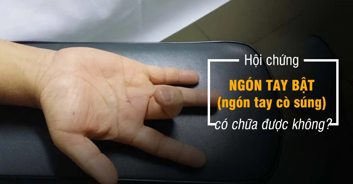 Ngón tay bật là gì, ai dễ mắc phải căn bệnh này