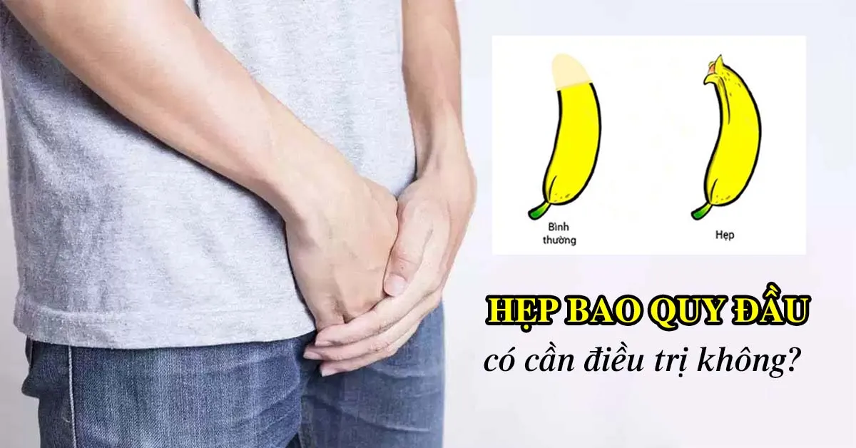 Những điều cần biết về hẹp bao quy đầu ở bé trai và nam giới