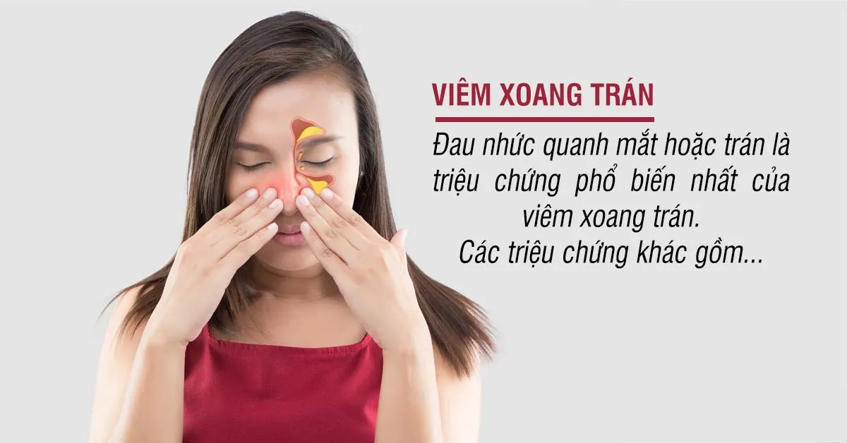 Viêm xoang trán – dấu hiệu và hướng điều trị đúng, tránh tái phát