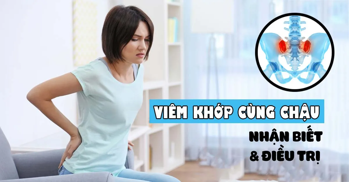 Viêm khớp cùng chậu là gì? Đối tượng dễ mắc bệnh, biểu hiện và cách chữa trị