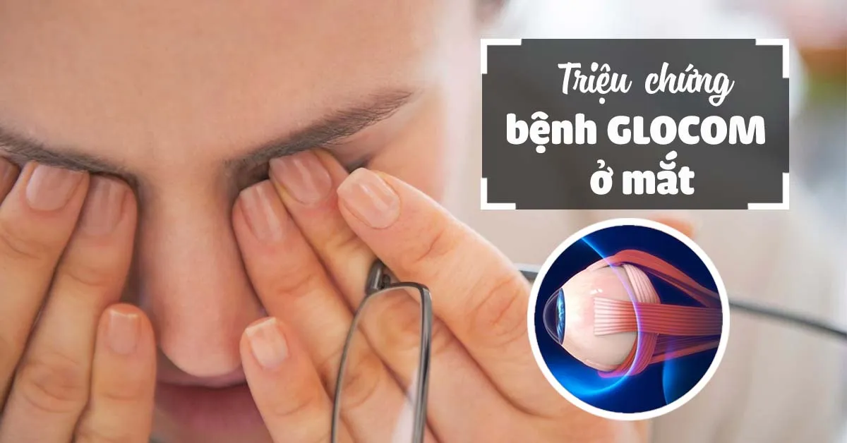 Những đối tượng dễ mắc bệnh glocom