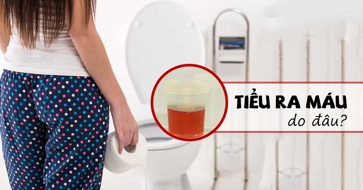 Tiểu ra máu là triệu chứng của bệnh gì?