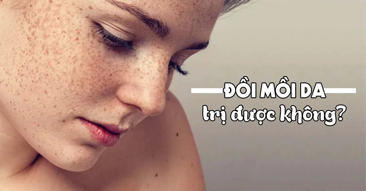Đồi mồi là gì, bao nhiêu tuổi thì da có đồi mồi?