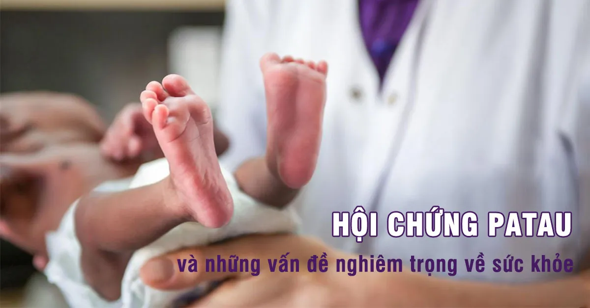 Hội chứng Patau là gì, nguy hiểm thế nào?