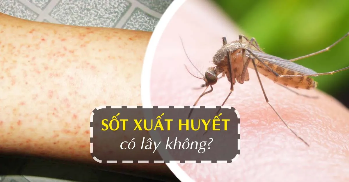 Sốt xuất huyết: những kiến thức cần nắm rõ để phòng tránh