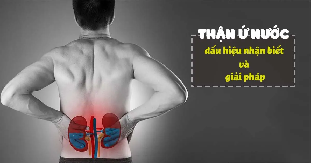 Điểm mặt những ‘thủ phạm’ gây thận ứ nước