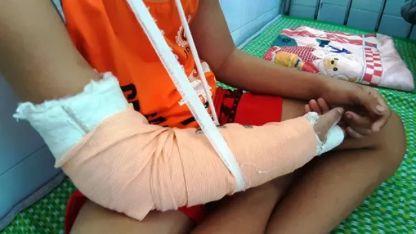 Tin pháp luật hôm nay 16/7/2019: Truy tìm đối tượng đánh gãy tay cháu bé bán vé số, cướp tài sản