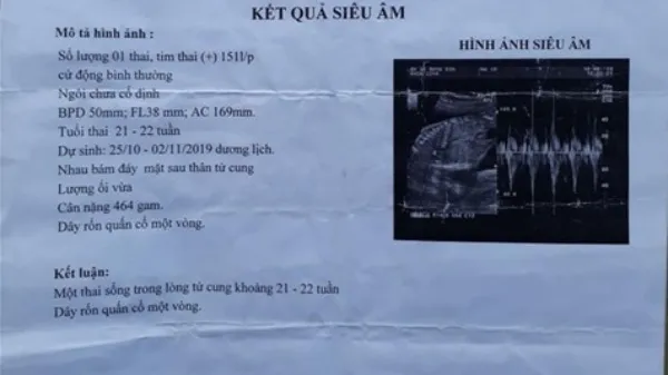 Tin tức pháp luật hôm nay 21/7/2019: Truy tìm đối tượng xâm hại bé gái 14 tuổi, mang thai 6 tháng