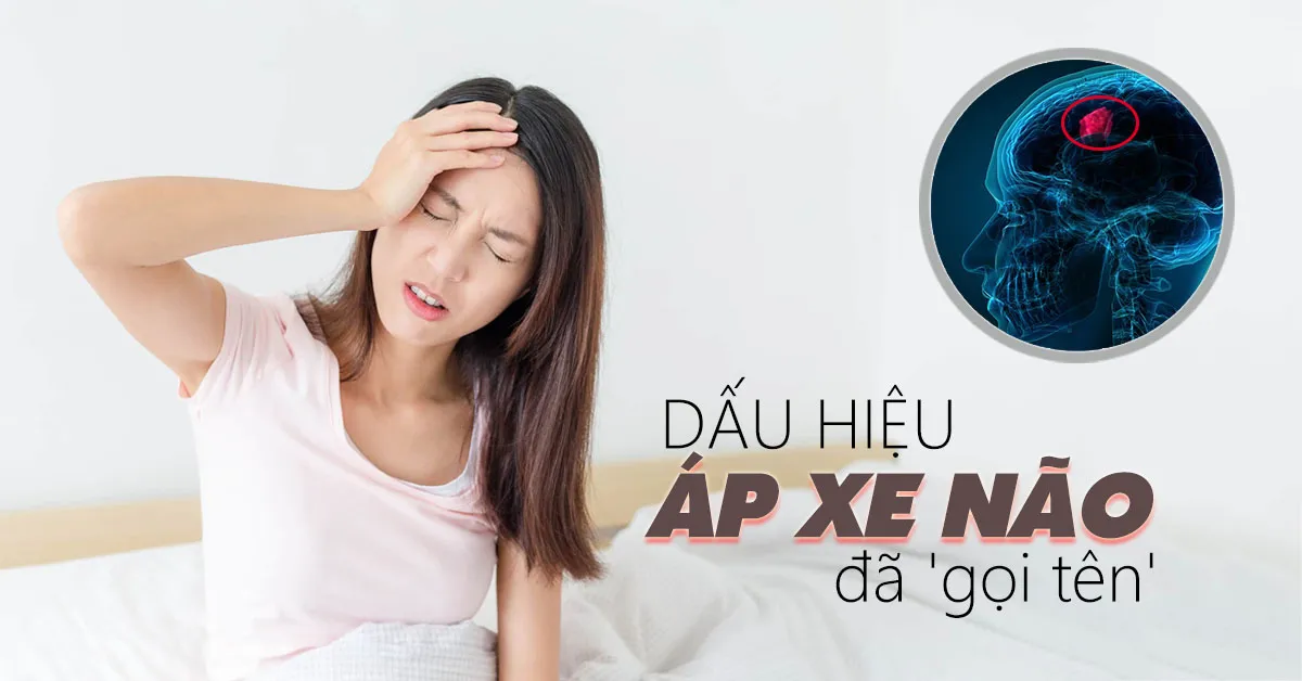 Áp xe não – căn bệnh nguy hiểm cần được phát hiện sớm