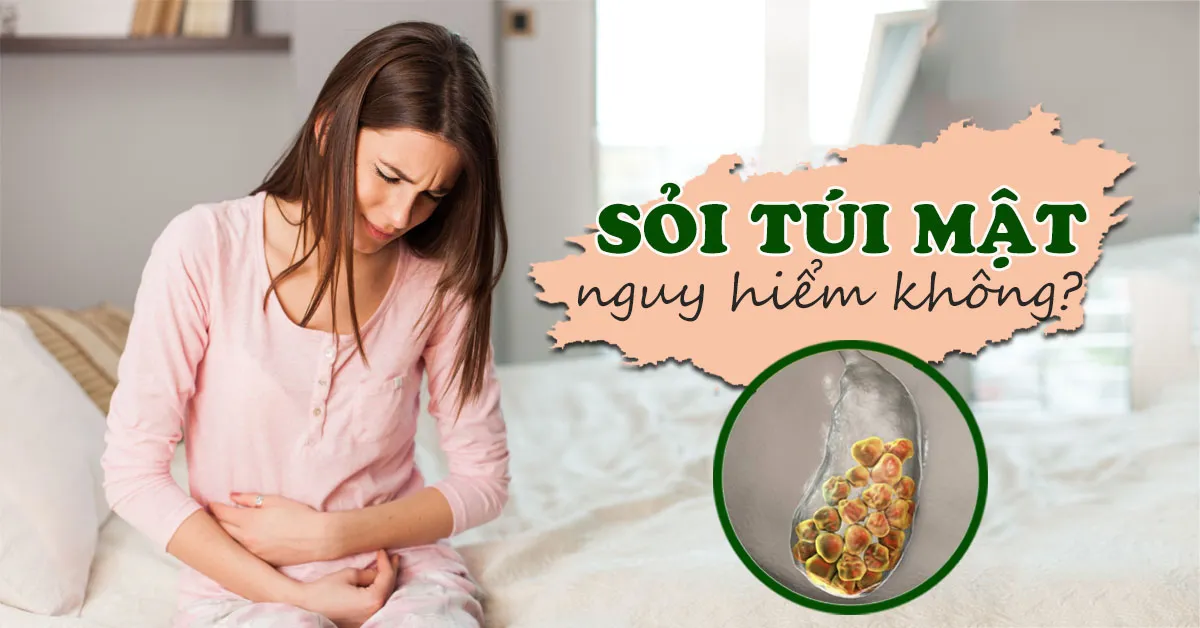 Sỏi túi mật và những điều cần biết