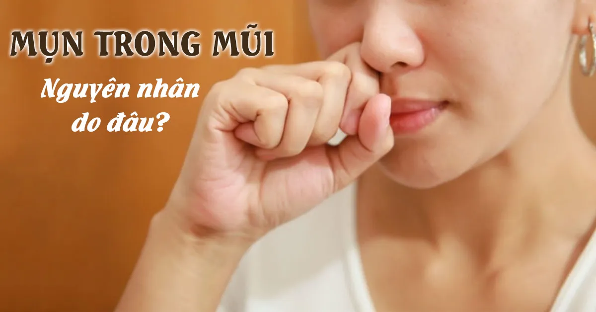 Mụn trong mũi: Nguyên nhân và cách phòng ngừa