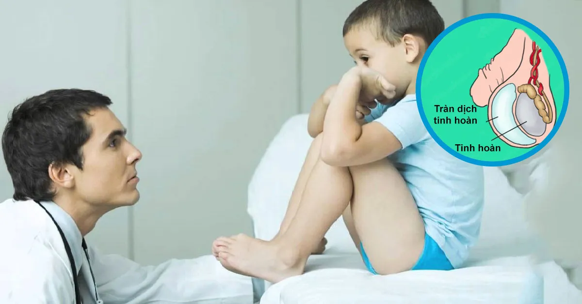 Tràn dịch tinh hoàn ở trẻ em là bệnh gì?