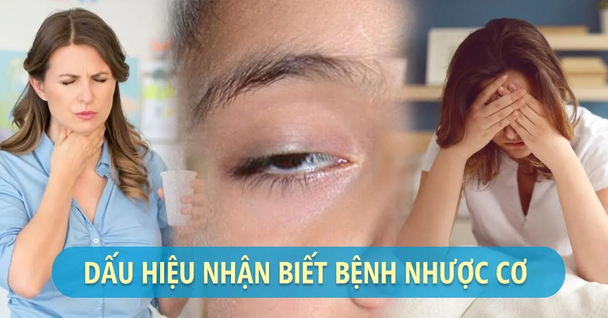 Bệnh nhược cơ là gì, mức độ nguy hiểm của bệnh ra sao?
